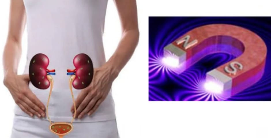 Biomagnetismo no tratamento de infecção urinária.