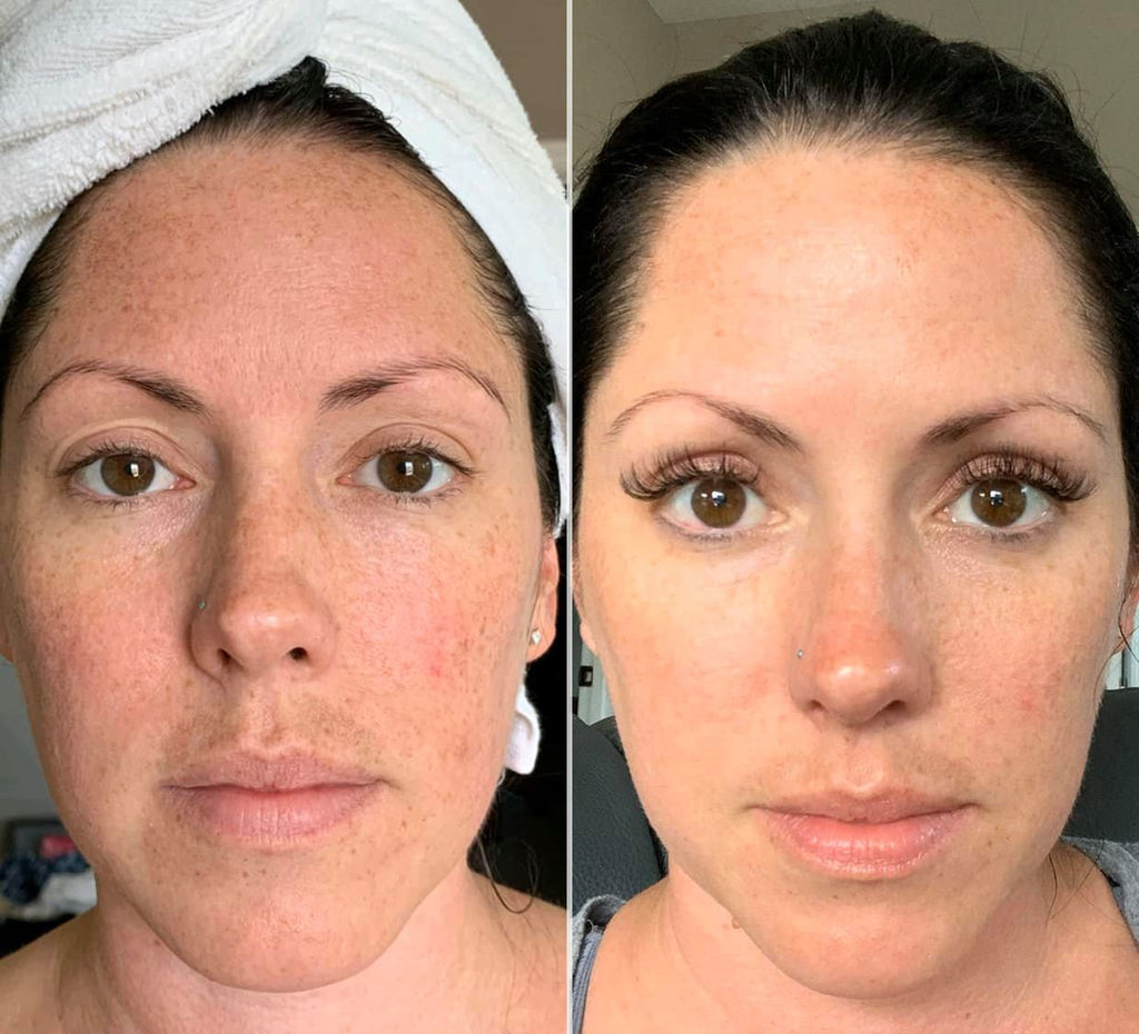 monat skin reviews
