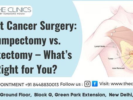 Breast Cancer Surgery: Lumpectomy vs. Mastectomy – What’s Right for You?