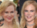 Nicole Kidman Plastic Surgery
