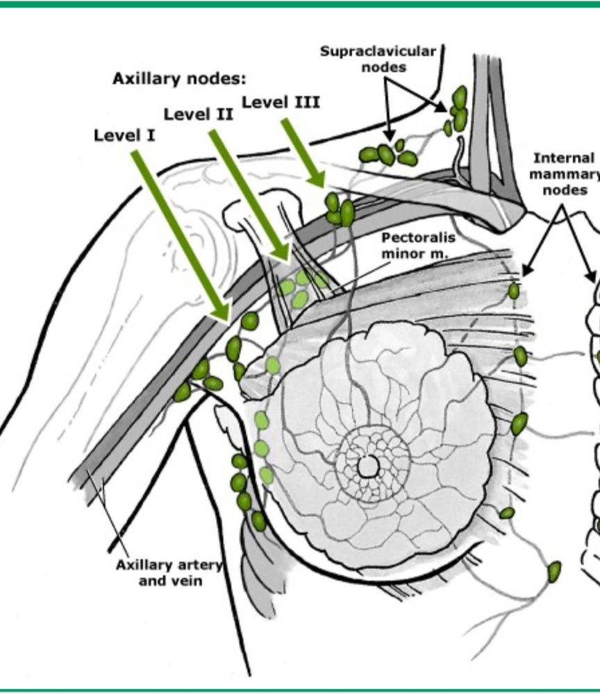 axillary-lymph-node-s-part-deux
