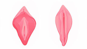 4 فوائد تحققها عملية تضييق المهبل