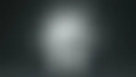 Common Myths About Dental Extraction Debunked