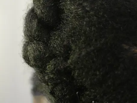 Inspiring Transformations: Real-Life Hair Transplant Success Stories