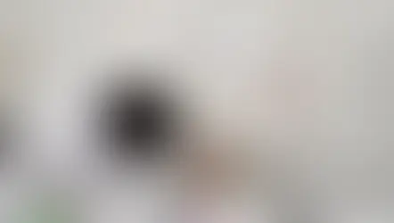 Why Should You Consider Nitrous Oxide Sedation for a Relaxing Dental Experience at Rams Dental World, Nellore?