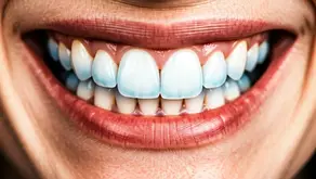 What Are Ozempic Teeth and How Do They Affect Oral Health?