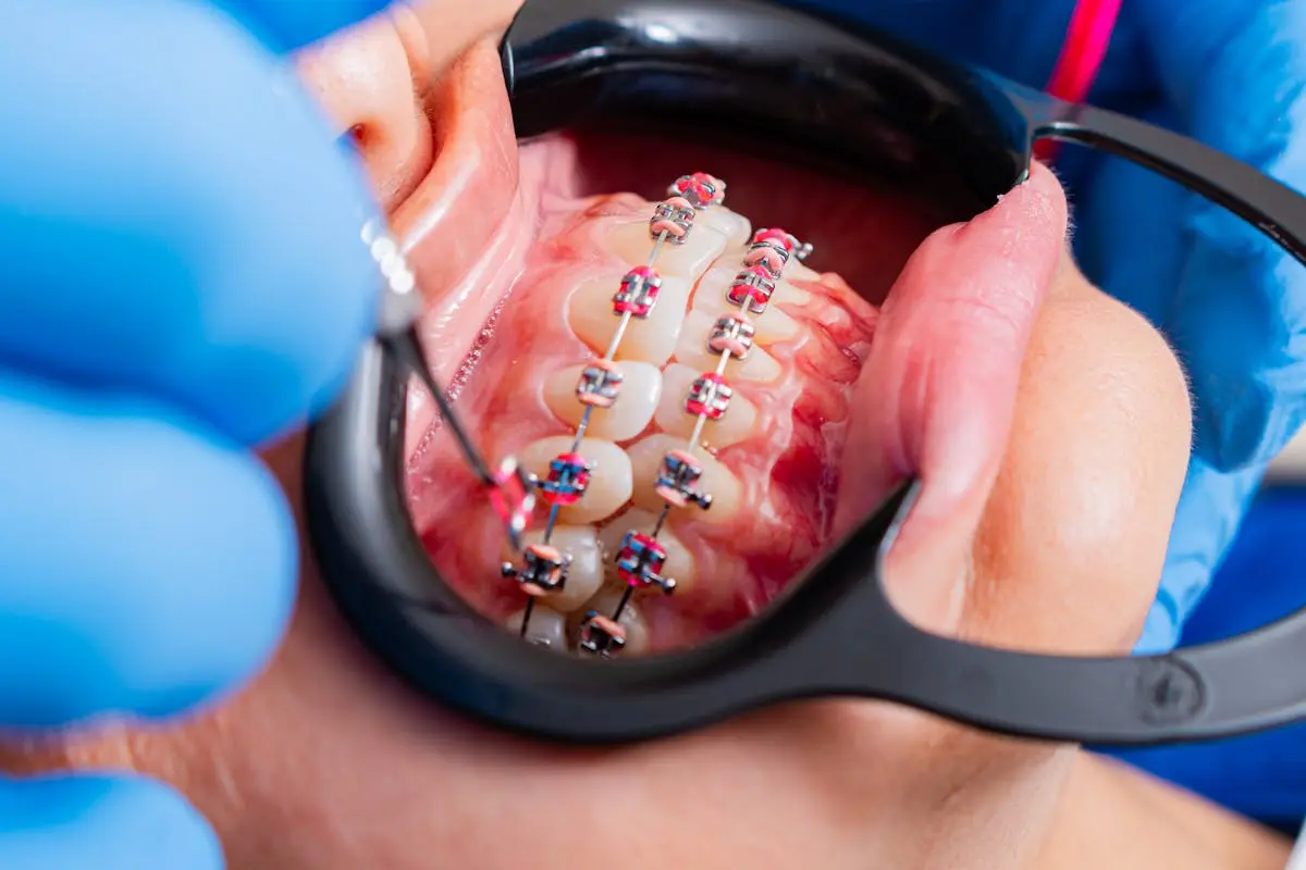 How to Choose the Right Orthodontic Treatment for Adults