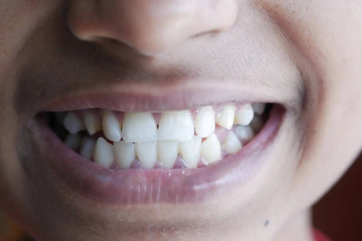 Can Gum Disease Affect Overall Health?