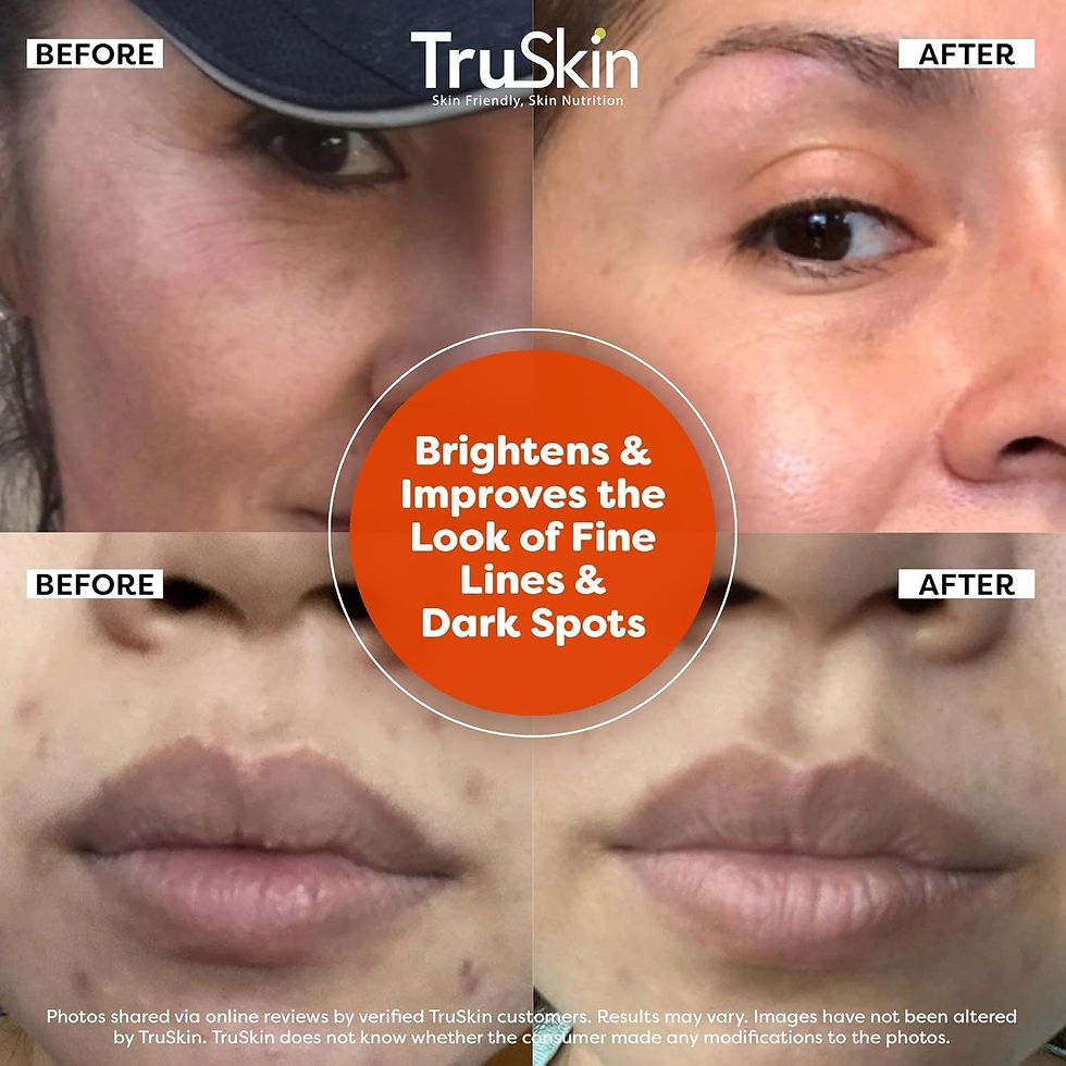 Thumbnail: TruSkin Vitamin C Serum For Face – Anti Aging Face Serum with Vitamin C, Hyal...