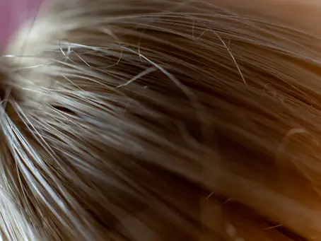 Understanding the Long-Term Monitoring of Hair Transplant Outcomes