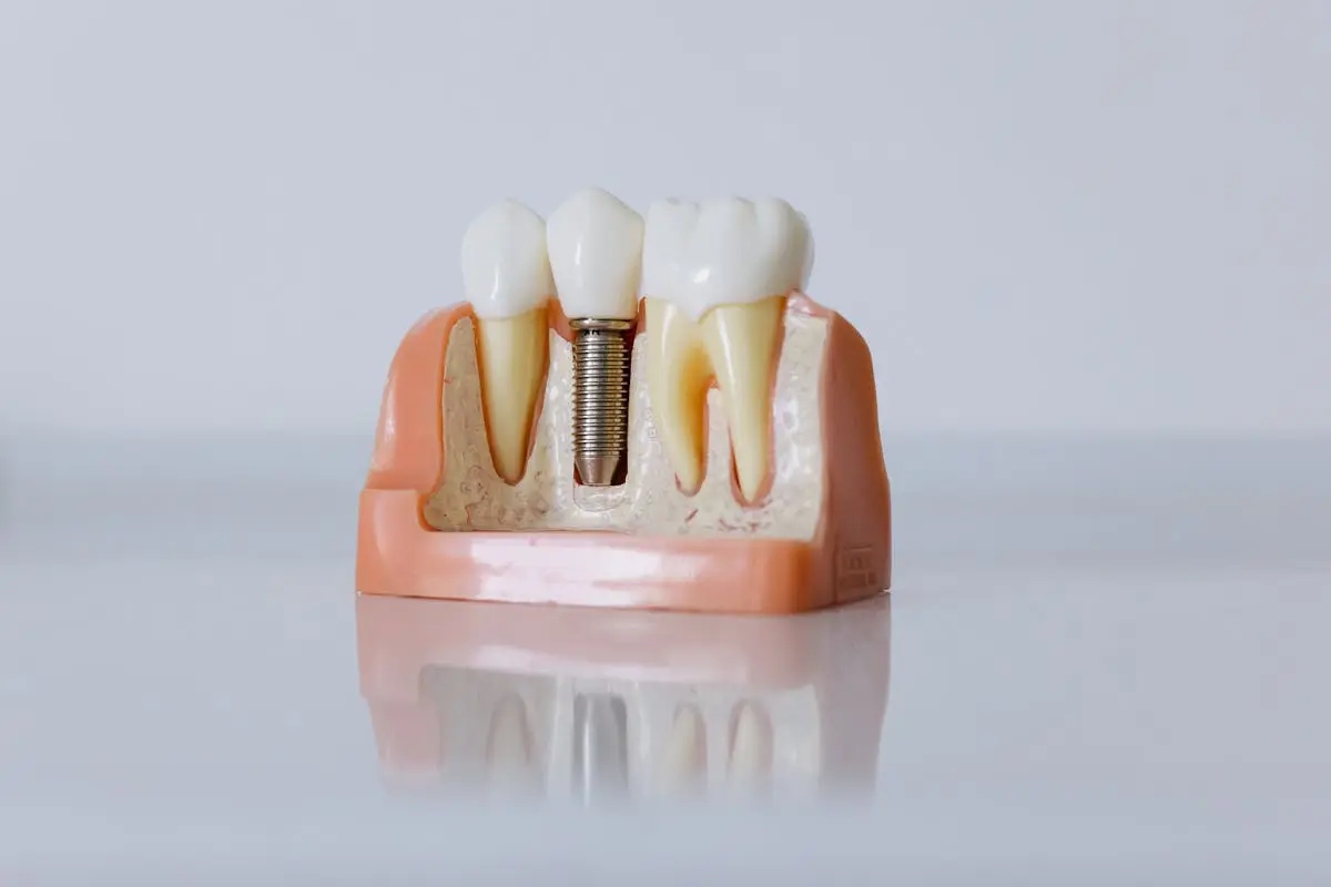 How Dental Implants Benefit Your Oral Health