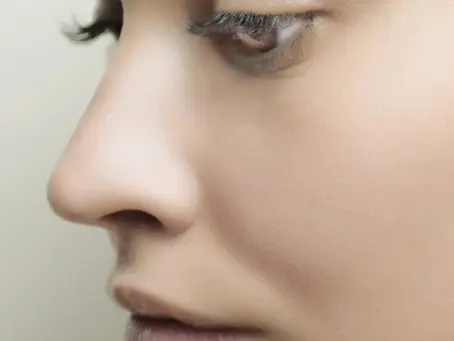 Top 10 Questions You Should Ask Your Medspa About Cherry Angioma Removal