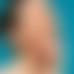 Understanding the Magic of Wheaton Botox for a Youthful Glow