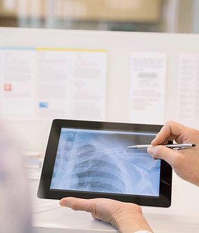 X-Ray