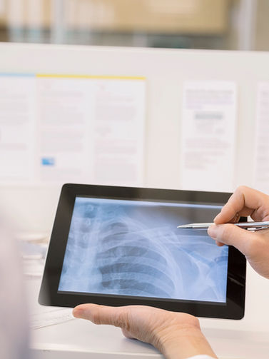 X-Ray