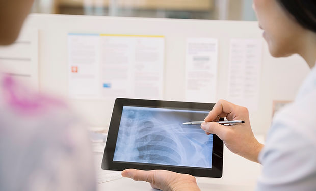 X-Ray