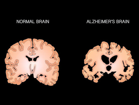 June is Alzheimer’s Awareness Month!