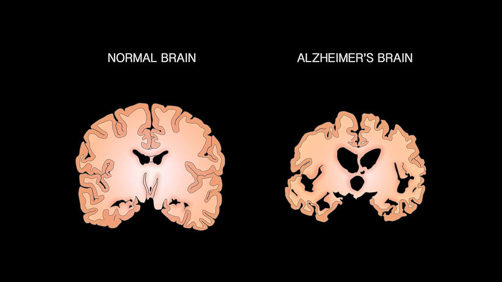 June is Alzheimer’s Awareness Month!