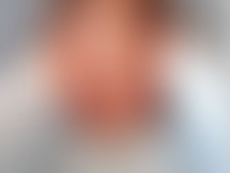 Cílios invertidos e Duto lacrimal