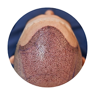 Stories a la une SoKate.png