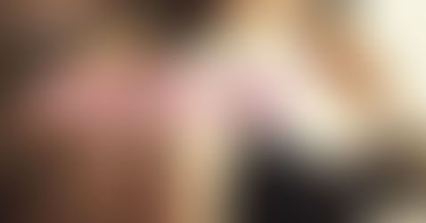 【水滴形果凍隆乳】告別長肉不長胸,木蘭常出征的窘境