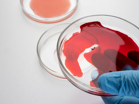 Immune Health: What's Real, What's Marketing, and What Medicine Agrees On