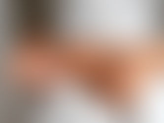 Skinny, But Stuck: The Overlooked Reality of Insulin Resistance in Lean Individuals