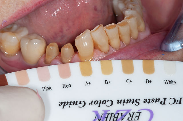 Estetica Dentale