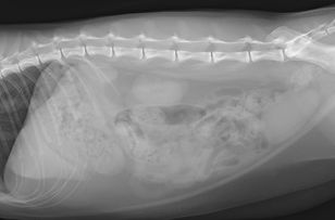 腹部レントゲン