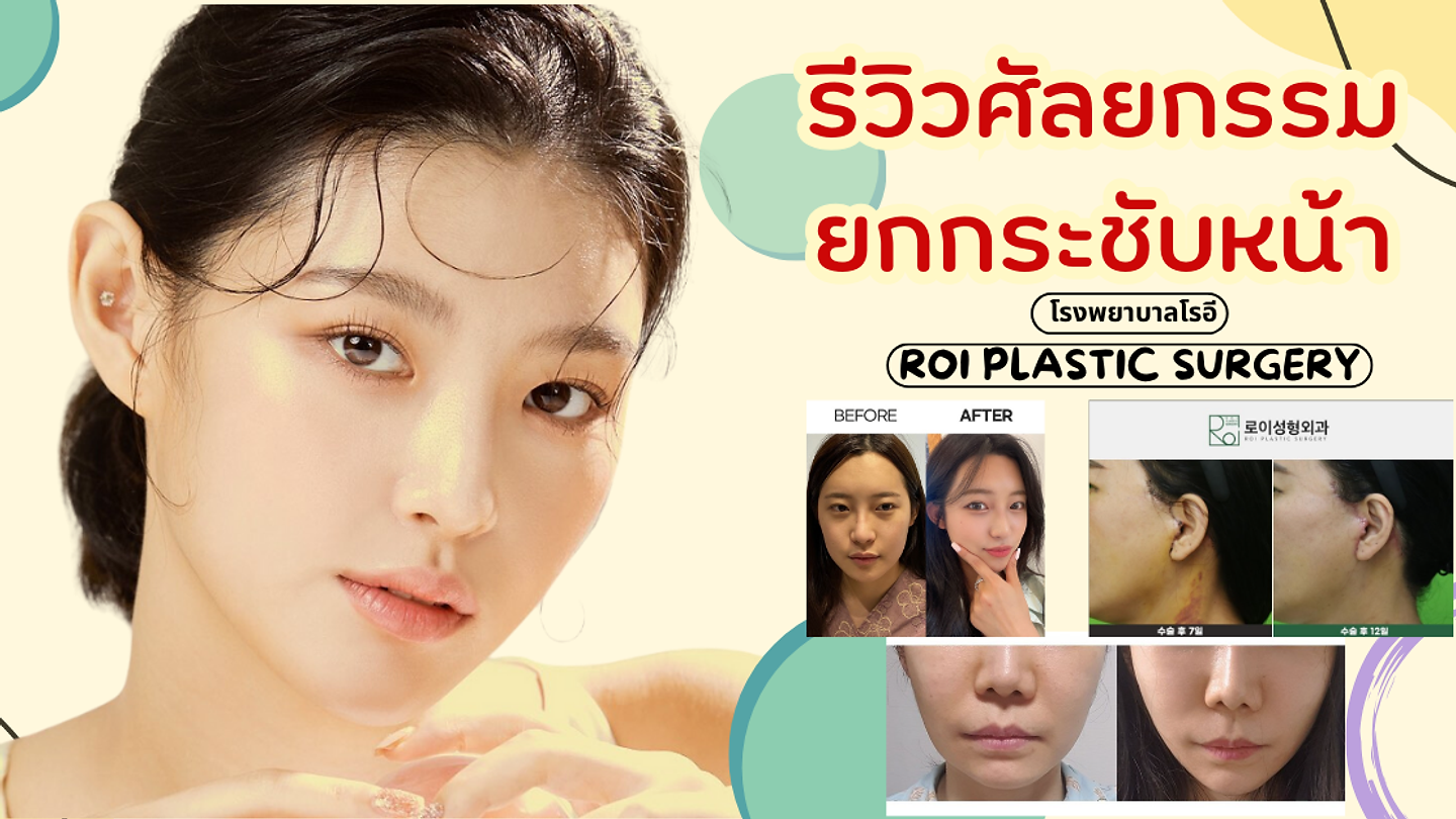 รีวิวศัลยกรรมยกกระชับหน้า ที่โรงพยาบาลโรอี ROI PLASTIC SURGERY