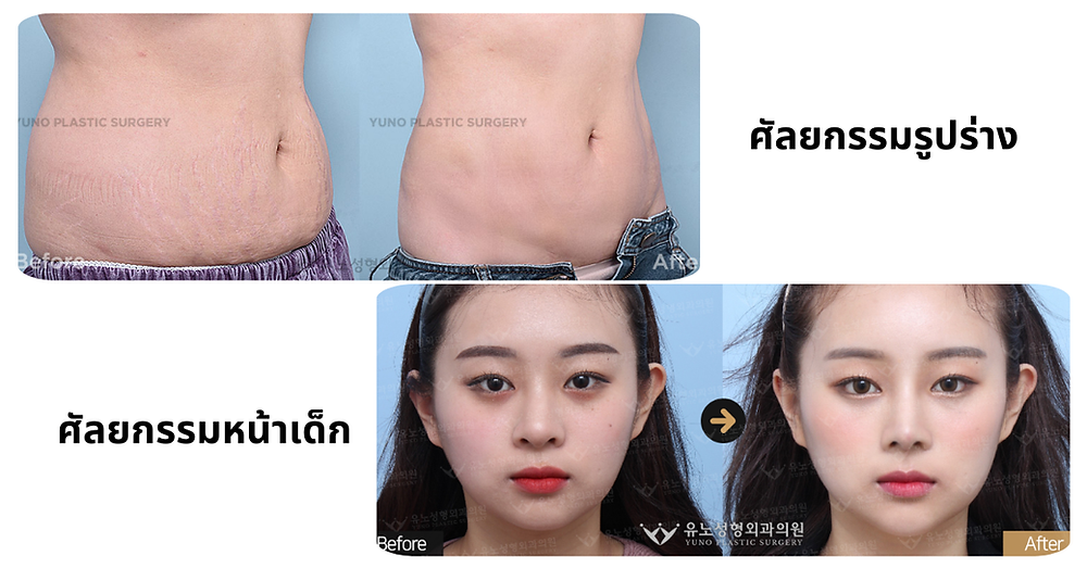 ทำไมถึงต้องเลือก โรงพยาบาลยูโน