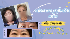 ศัลยกรรมตาหนังตาตกแก้ได้ที่โรงพยาบาลยูโน Yuno Plastic Surgery พร้อมรีวิวของจริง