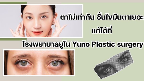 ตาไม่เท่ากัน ชั้นไขมันตาเยอะแก้ได้ที่โรงพยาบาลยูโน Yuno Plastic surgery ช่วยสวยแบบธรรมชาติ