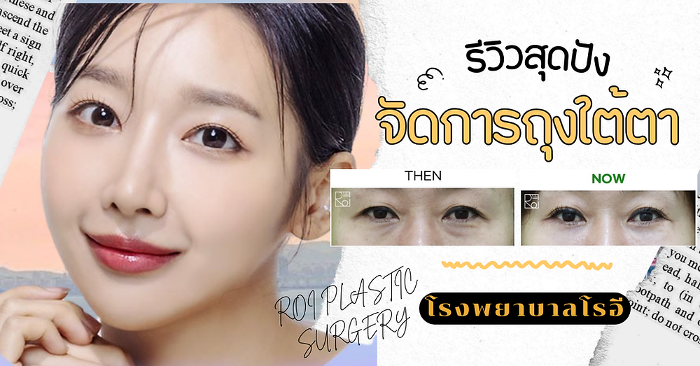 รีวิวจัดเรียงไขมันใต้ตา