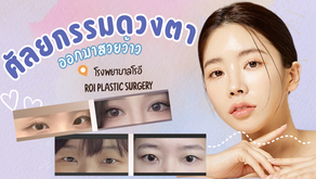 ศัลยกรรมตา ออกมาสวยว้าวกับโรงพยาบาลโรอี ROI PLASTIC SURGERY