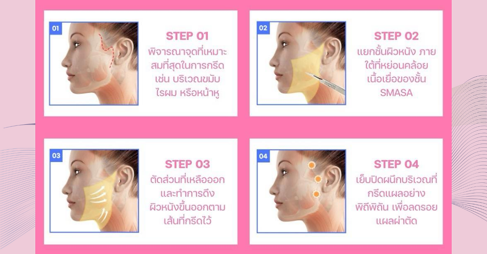 ศัลยกรรมหน้าเด็ก