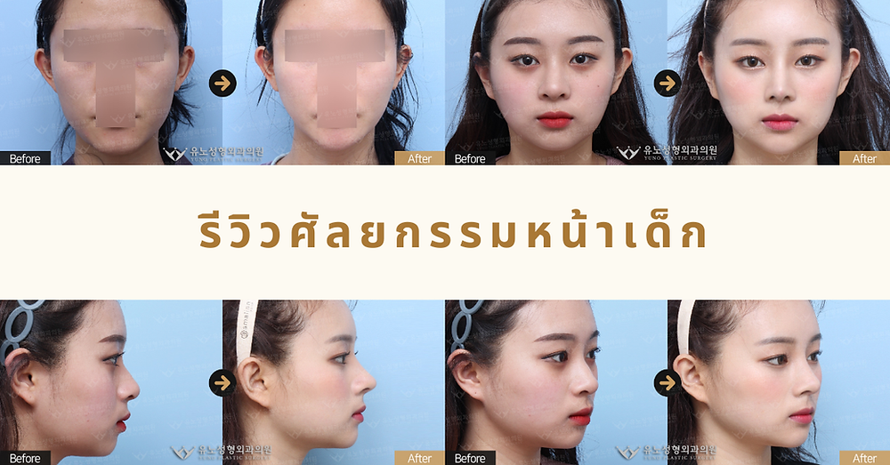 เปิดวาร์ปศัลยกรรมที่โรงพยาบาลยูโน