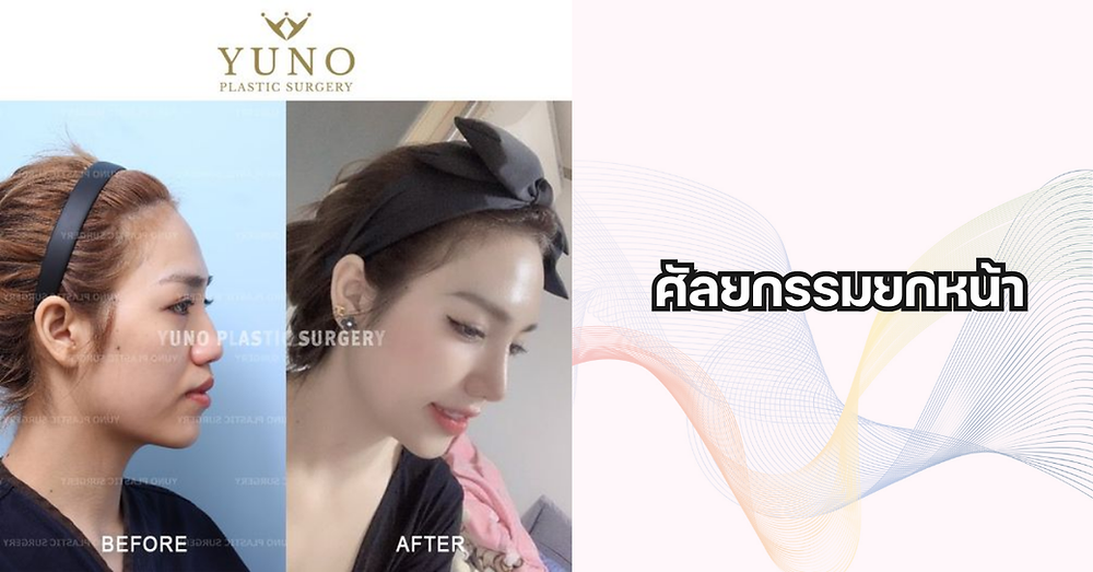 ศัลยกรรมหน้าเด็ก