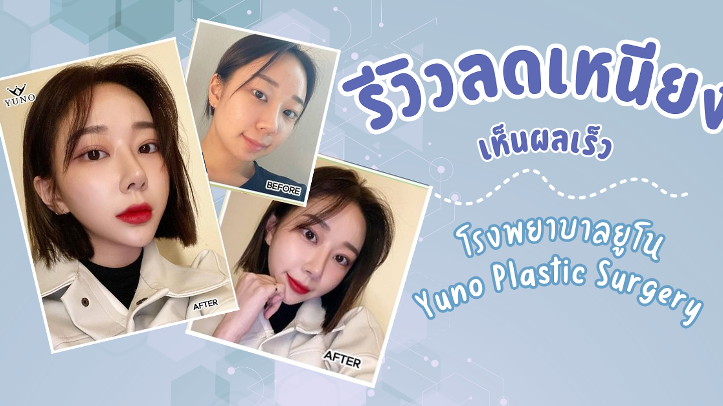 รีวิวลดเหนียงแบบเห็นผลเร็ว มาที่โรงพยาบาลยูโน Yuno Plastic Surgery