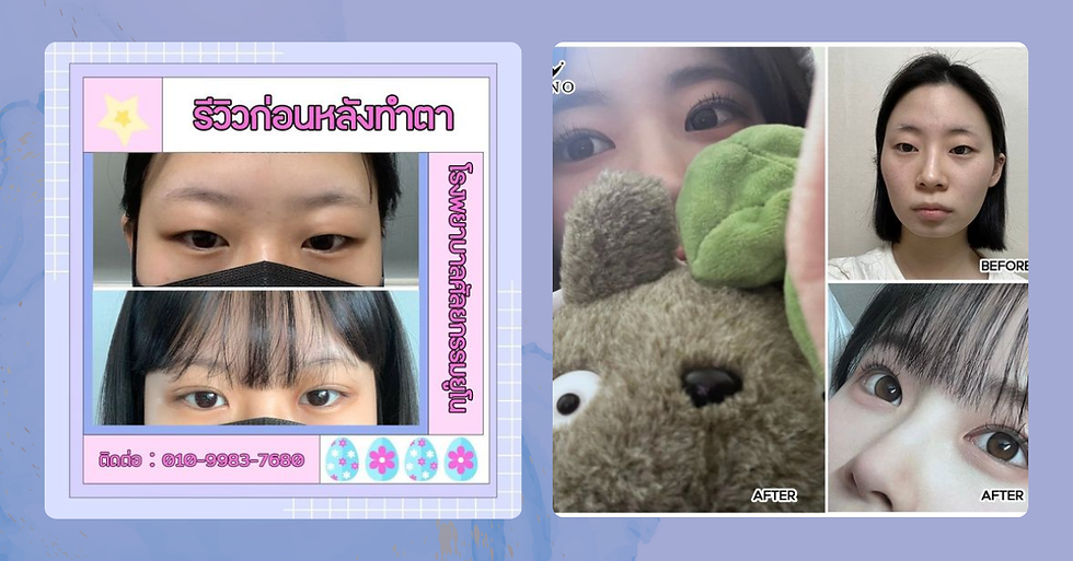 ศัลยกรรมตาหนังตาตก