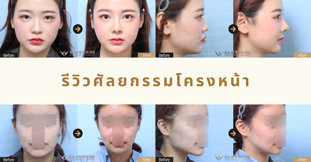 เปิดวาร์ปศัลยกรรมที่โรงพยาบาลยูโน