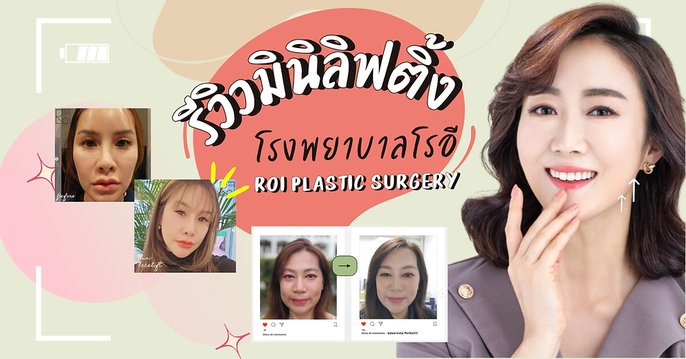 รีวิวมินิลิฟติ้ง