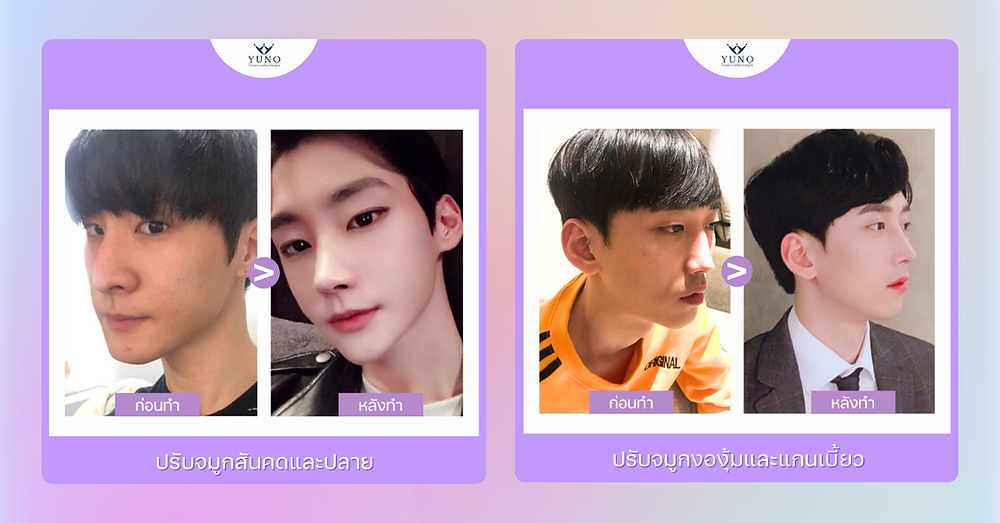 เริ่มต้นศัลยกรรมส่วนไหนดี