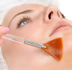 dermaplaning, calgary, pretty esthetics, facial treatments, eyebrows