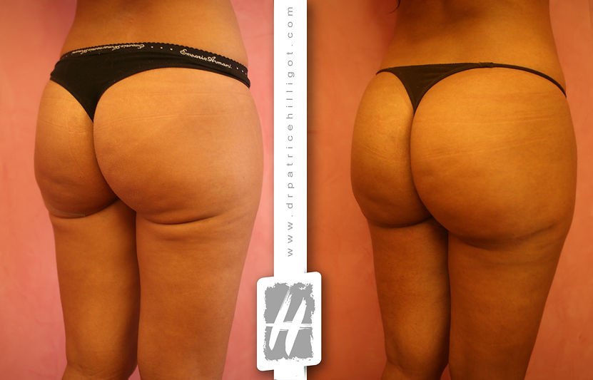 av-fesses-5-2.jpg