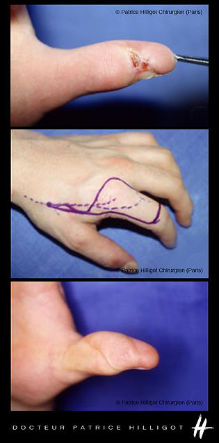 doigts-dorsal.jpg