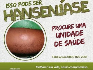 Gerência Regional de Saúde de Canoinhas chama atenção para diagnóstico precoce da Hanseníase
