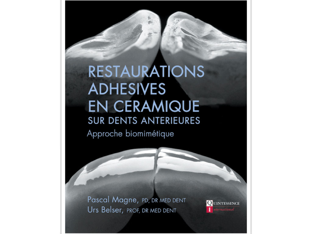 Restaurations Adhésives en Céramique