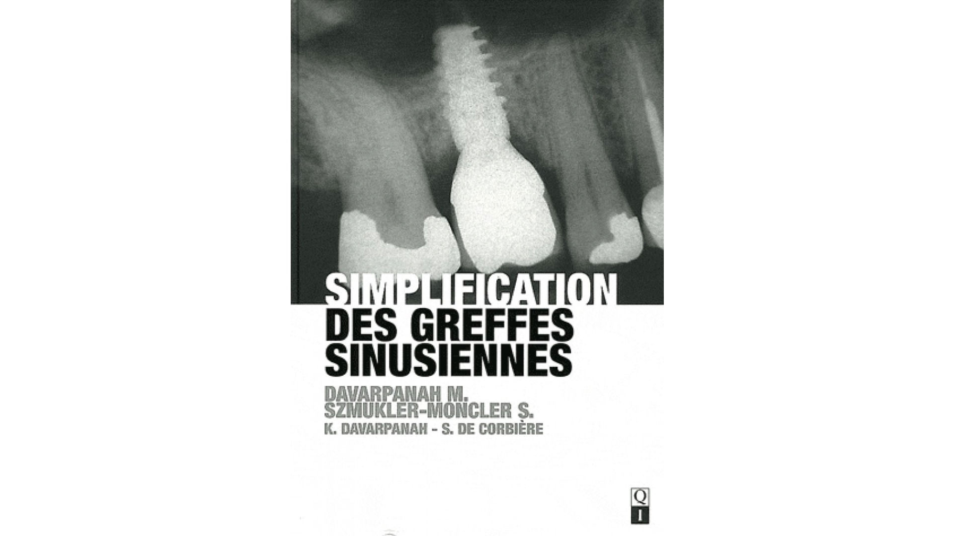 Simplification des Greffes Sinusiennes