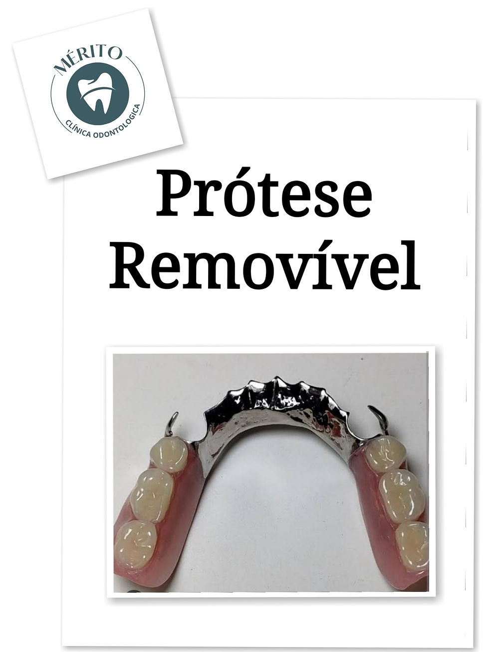 Prótese removível
